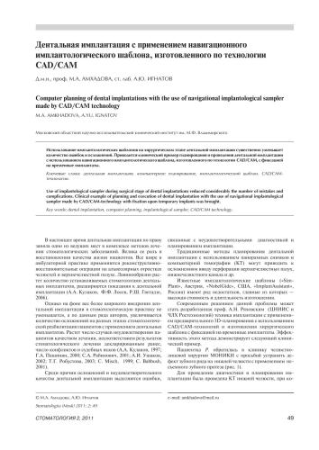 Дентальная имплантация с применением навигационного имплантологического шаблона, изготовленного по технологии CAD/CAM