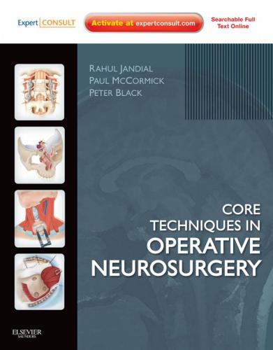 Core Techniques in Operative Neurosurgery V.2