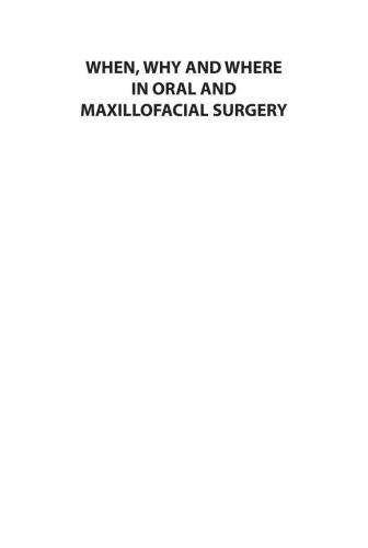 When, Why and Where in Oral and Maxillofacial Surgery. Part III