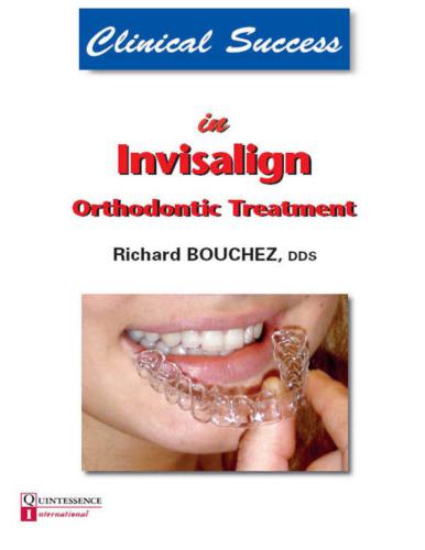 Clinical Success in Invisalign Orthodontic Treatment
