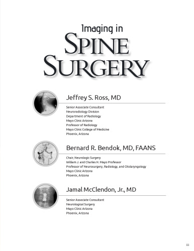 Imaging in Spine Surgery