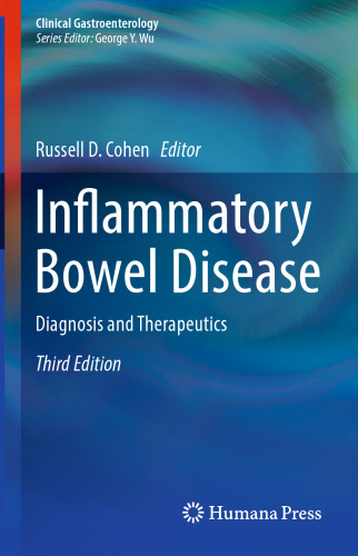 Inflammatory Bowel Disease: Diagnosis and Therapeutics