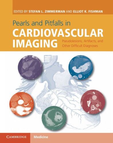 Pearls and pitfalls in cardiovascular imaging : pseudolesions, artifacts and other difficult diagnoses