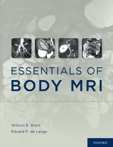 Essentials of body MRI