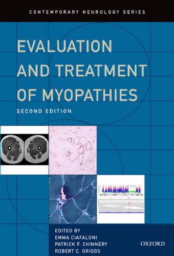 Evaluation and treatment of myopathies
