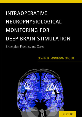 Intraoperative neurophysiological monitoring for deep brain stimulation : principles, practice, and cases