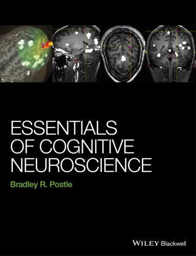Essentials of cognitive neuroscience