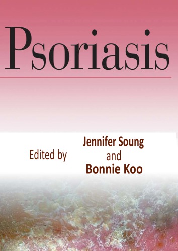 Psoriasis