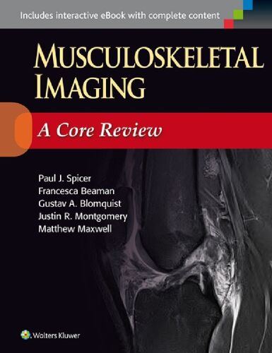 Musculoskeletal imaging a core review : [includes interactive ebook with complete content]