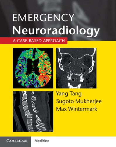 Emergency Neuroradiology: A Case-Based Approach