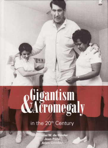 Gigantism & Acromegaly in the 20th Century
