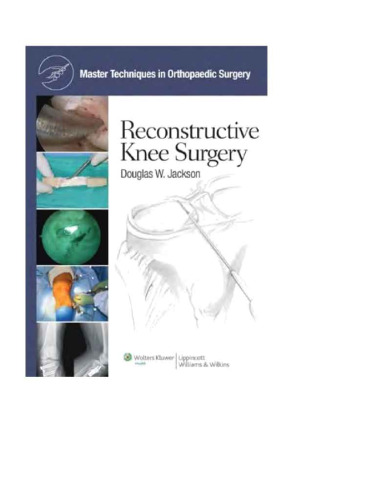 Master Techniques in Orthopaedic Surgery Reconstructive Knee Surgery