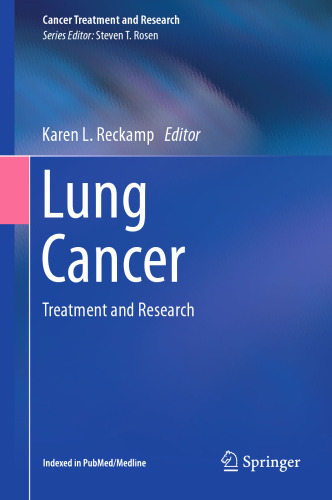 Lung Cancer: Treatment and Research