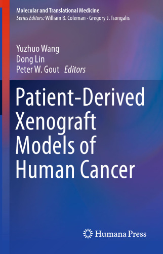 Patient-derived xenograft models of human cancer