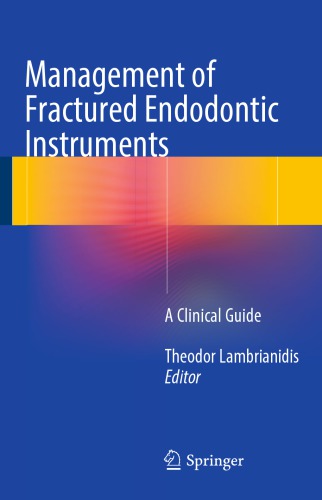 Management of fractured endodontic instruments : a clinical guide