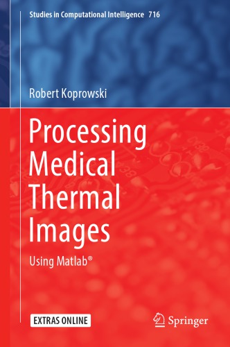 Processing Medical Thermal Images : Using Matlab®