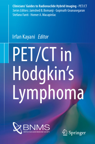  PET/CT in Hodgkin’s Lymphoma