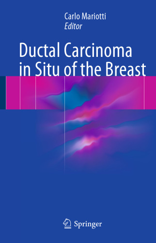  Ductal Carcinoma in Situ of the Breast