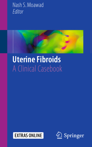  Uterine Fibroids: A Clinical Casebook