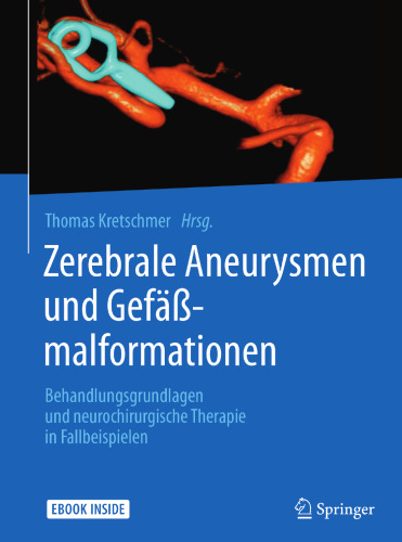  Zerebrale Aneurysmen und Gefäßmalformationen: Behandlungsgrundlagen und neurochirurgische Therapie in Fallbeispielen