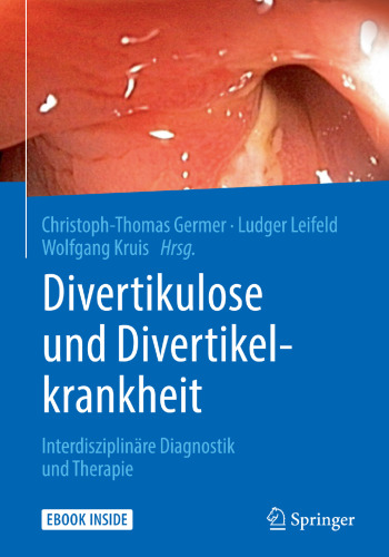Divertikulose und Divertikelkrankheit: Interdisziplinäre Diagnostik und Therapie