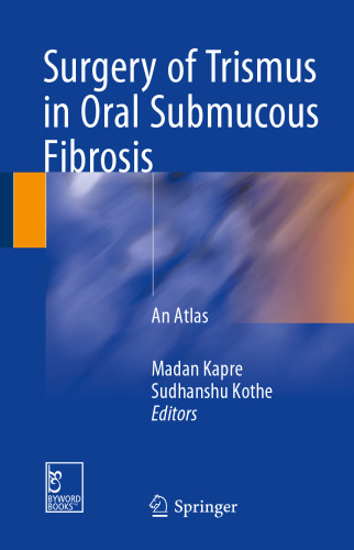 Surgery of Trismus in Oral Submucous Fibrosis: An Atlas