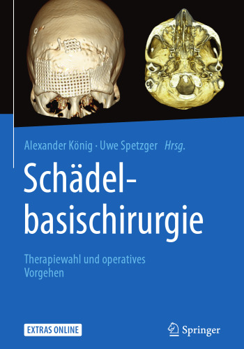 Schädelbasischirurgie: Therapiewahl und operatives Vorgehen