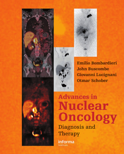 Advances in Nuclear Oncology:: Diagnosis and Therapy