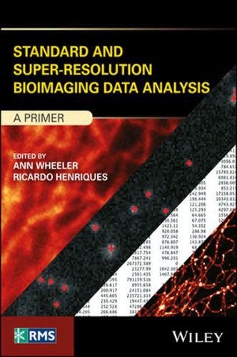 Standard and Super‐Resolution Bioimaging Data Analysis: A Primer
