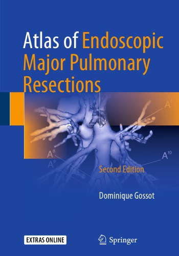 Atlas of Endoscopic Major Pulmonary Resections