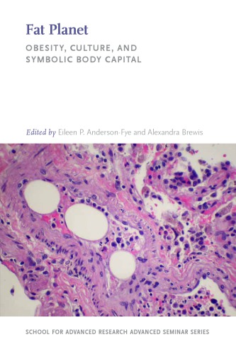 Fat Planet: Obesity, Culture, and Symbolic Body Capital