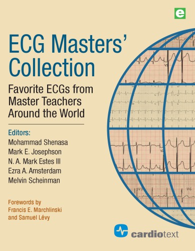ECG Masters Collection. Favorite ECGs From Master Teachers Around The World