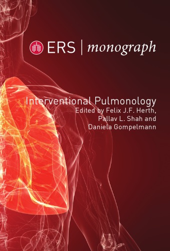 Interventional Pulmonology