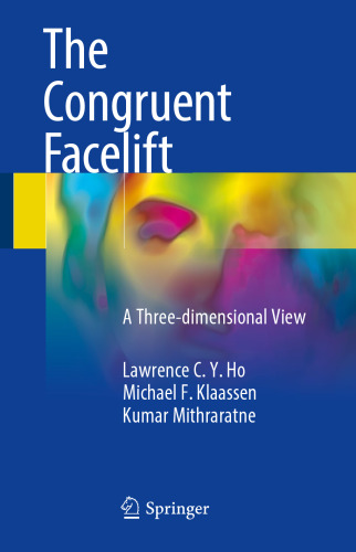 The Congruent Facelift: A Three-dimensional View