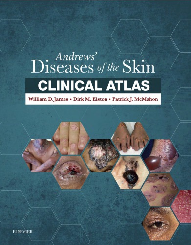 Andrews’ Diseases of the Skin Clinical Atlas