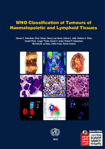 WHO Classification of Tumours of Haematopoietic and Lymphoid Tissues