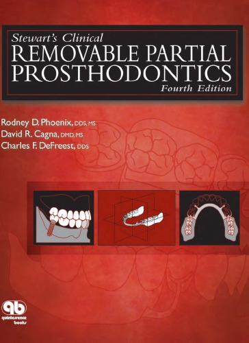 Stewart’s Clinical Removable Partial Prosthodontics