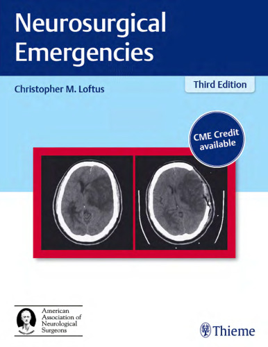 Neurosurgical Emergencies