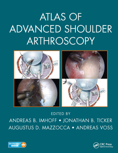 Atlas of Advanced Shoulder Arthroscopy