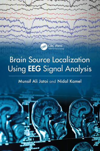 Brain Source Localization Using EEG Signal Analysis