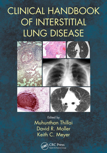 Clinical Handbook of Interstitial Lung Disease