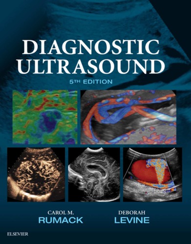 Diagnostic ultrasound