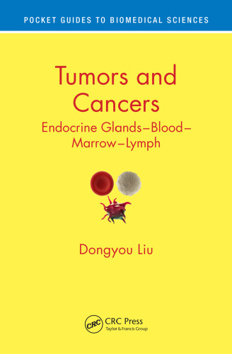 Tumors and cancers : endocrine glands - blood - marrow - lymph