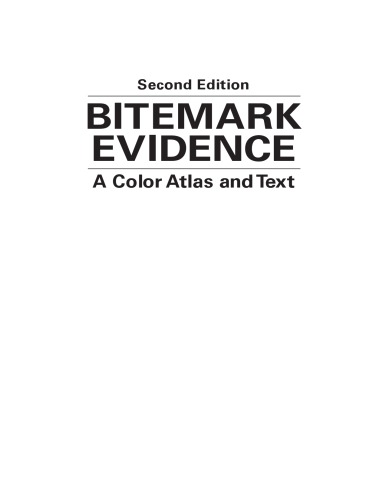 Bitemark evidence : a color atlas and text