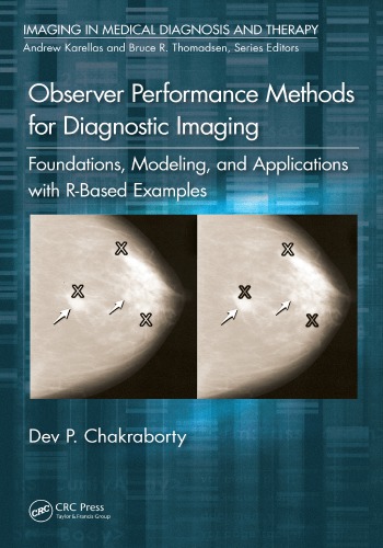 Observer performance methods for diagnostic imaging : foundations, modeling, and applications with R-based examples