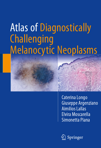  Atlas of Diagnostically Challenging Melanocytic Neoplasms