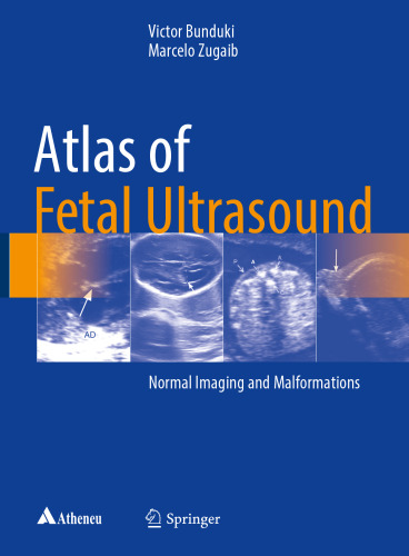  Atlas of Fetal Ultrasound: Normal Imaging and Malformations