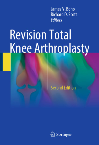 Revision Total Knee Arthroplasty