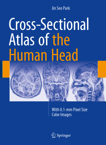  Cross-Sectional Atlas of the Human Head: With 0.1-mm pixel size color images