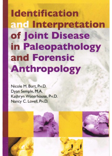 Identification and interpretation of joint disease in paleopathology and forensic anthropology